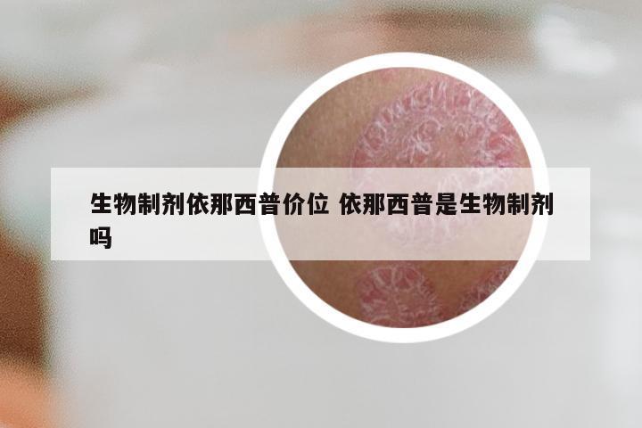 生物制剂依那西普价位 依那西普是生物制剂吗