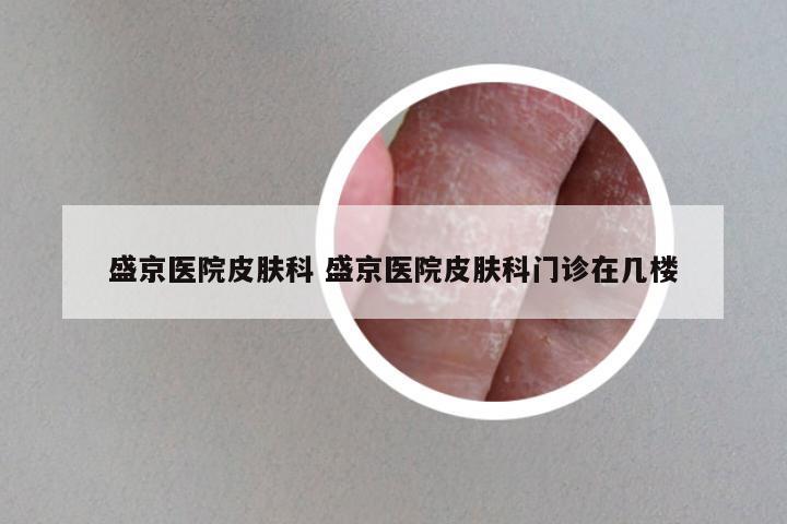 盛京医院皮肤科 盛京医院皮肤科门诊在几楼