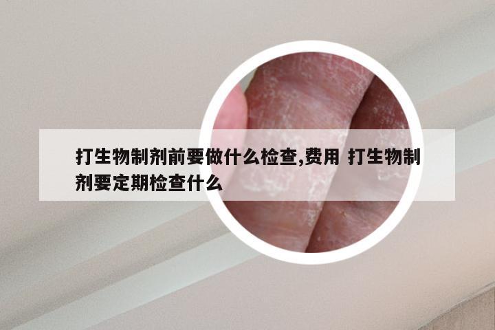 打生物制剂前要做什么检查,费用 打生物制剂要定期检查什么