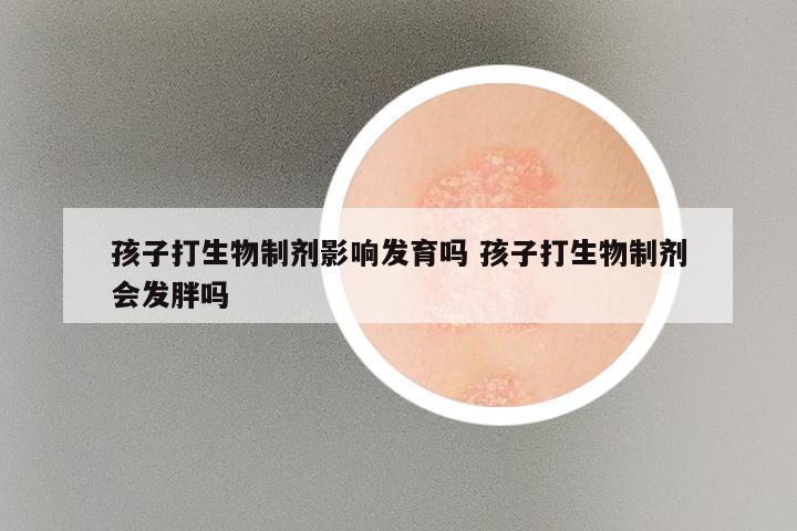 孩子打生物制剂影响发育吗 孩子打生物制剂会发胖吗