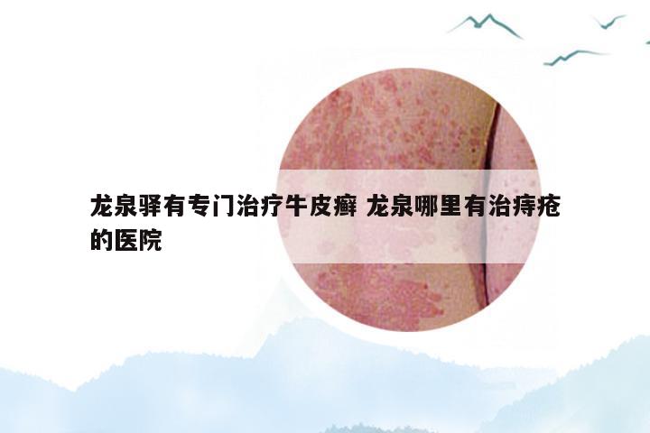 龙泉驿有专门治疗牛皮癣 龙泉哪里有治痔疮的医院