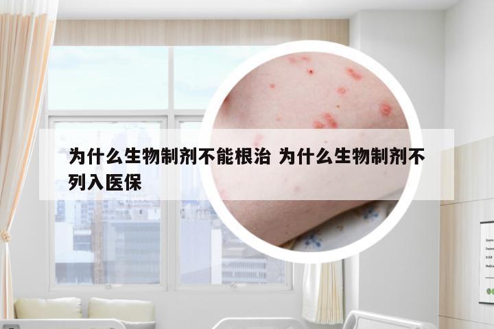 为什么生物制剂不能根治 为什么生物制剂不列入医保