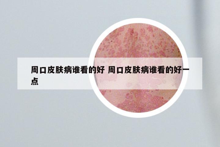 周口皮肤病谁看的好 周口皮肤病谁看的好一点