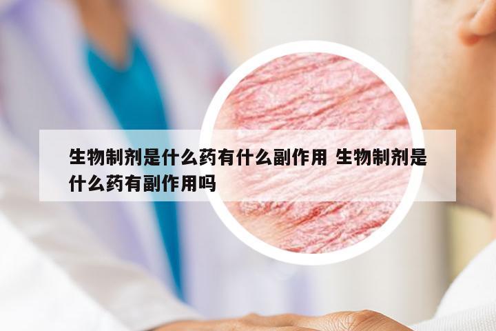生物制剂是什么药有什么副作用 生物制剂是什么药有副作用吗