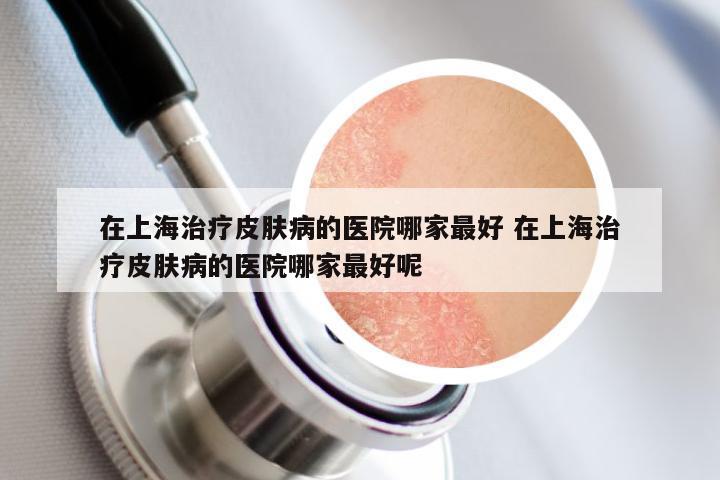 在上海治疗皮肤病的医院哪家最好 在上海治疗皮肤病的医院哪家最好呢