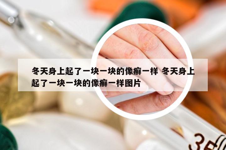 冬天身上起了一块一块的像癣一样 冬天身上起了一块一块的像癣一样图片