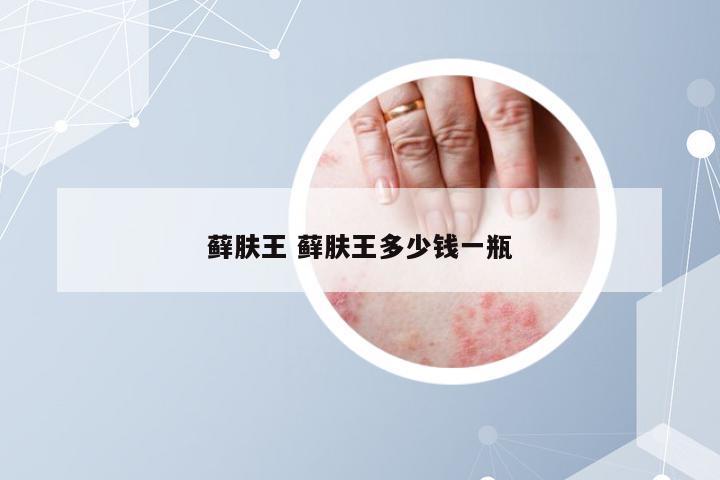 藓肤王 藓肤王多少钱一瓶