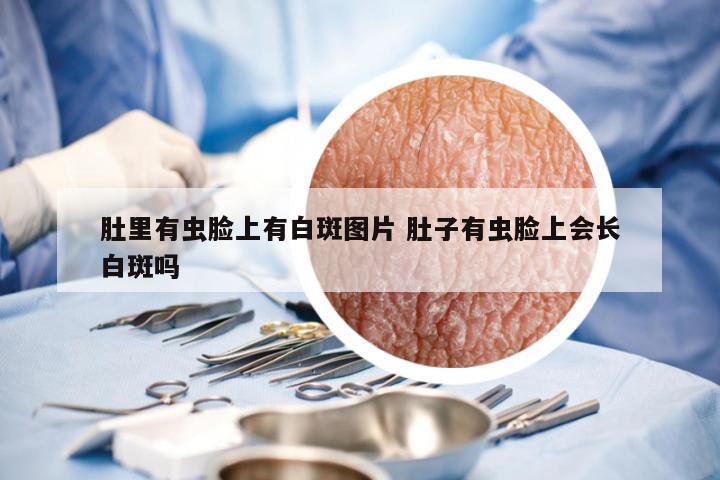 肚里有虫脸上有白斑图片 肚子有虫脸上会长白斑吗