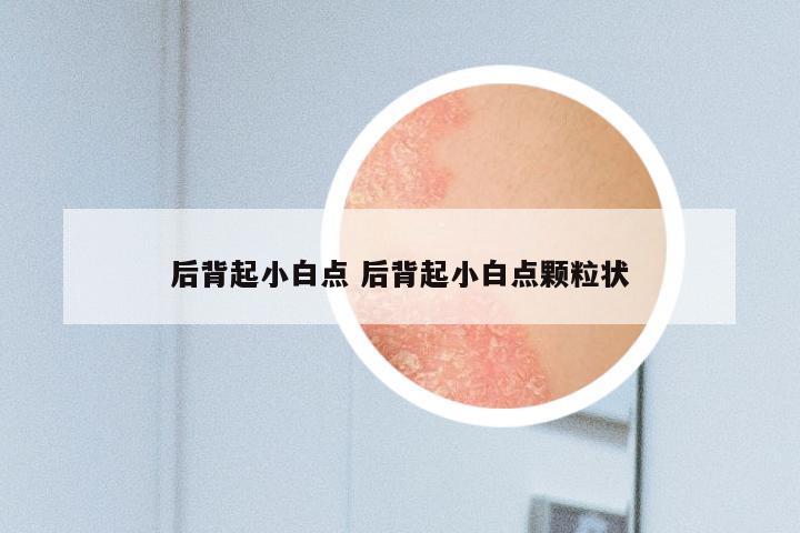 后背起小白点 后背起小白点颗粒状