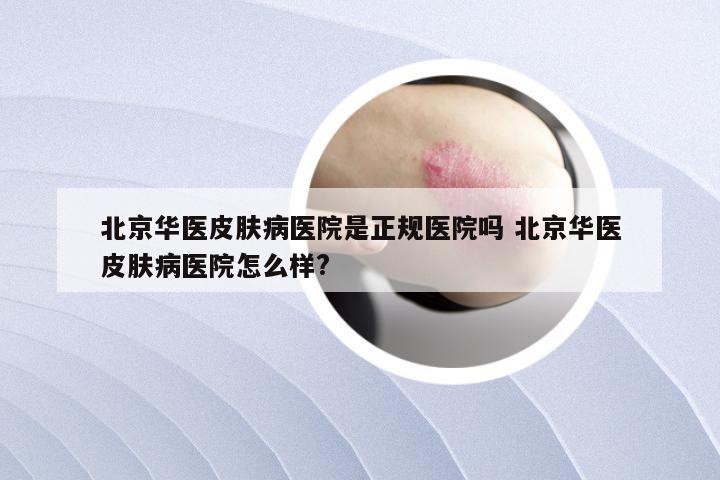 北京华医皮肤病医院是正规医院吗 北京华医皮肤病医院怎么样?