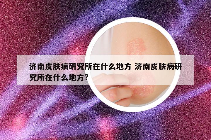济南皮肤病研究所在什么地方 济南皮肤病研究所在什么地方?