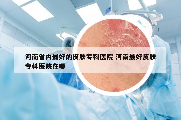 河南省内最好的皮肤专科医院 河南最好皮肤专科医院在哪