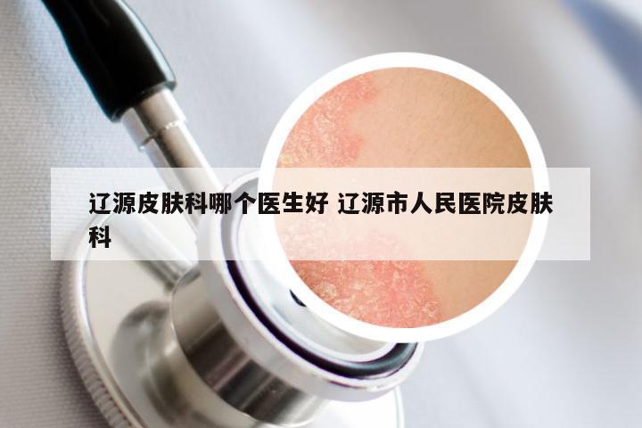 辽源皮肤科哪个医生好 辽源市人民医院皮肤科