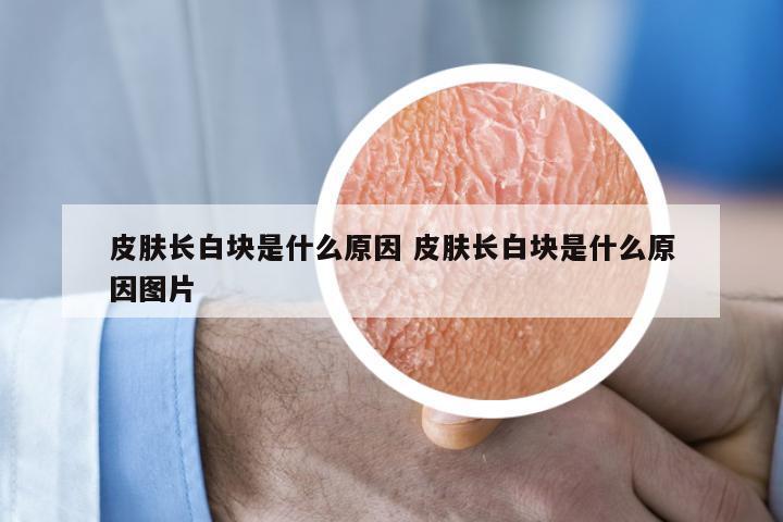 皮肤长白块是什么原因 皮肤长白块是什么原因图片