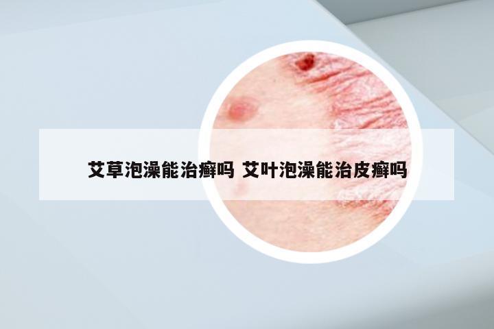 艾草泡澡能治癣吗 艾叶泡澡能治皮癣吗