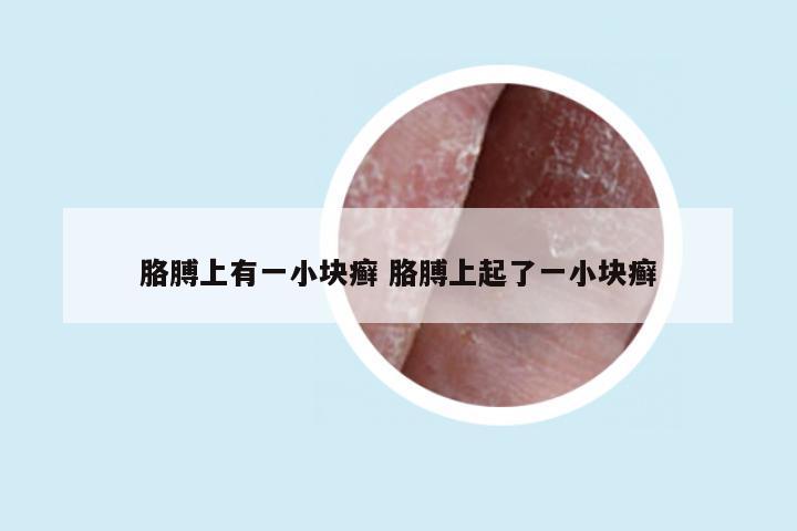 胳膊上有一小块癣 胳膊上起了一小块癣