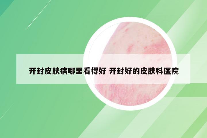开封皮肤病哪里看得好 开封好的皮肤科医院