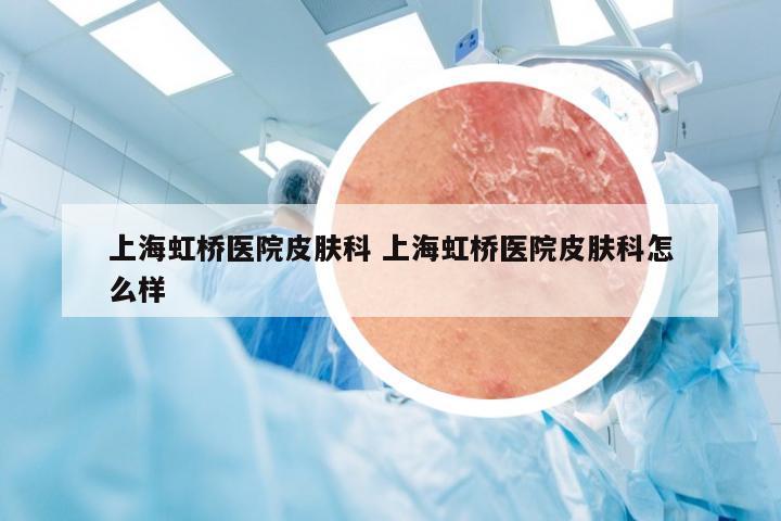 上海虹桥医院皮肤科 上海虹桥医院皮肤科怎么样