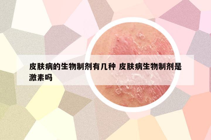皮肤病的生物制剂有几种 皮肤病生物制剂是激素吗