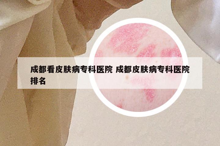成都看皮肤病专科医院 成都皮肤病专科医院排名