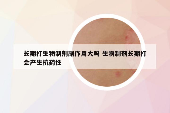 长期打生物制剂副作用大吗 生物制剂长期打会产生抗药性