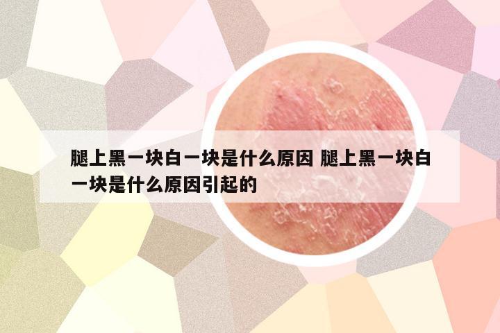 腿上黑一块白一块是什么原因 腿上黑一块白一块是什么原因引起的