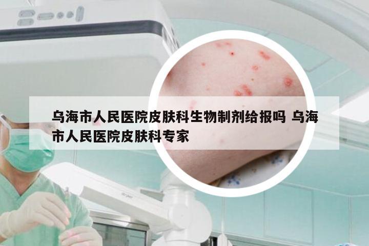 乌海市人民医院皮肤科生物制剂给报吗 乌海市人民医院皮肤科专家