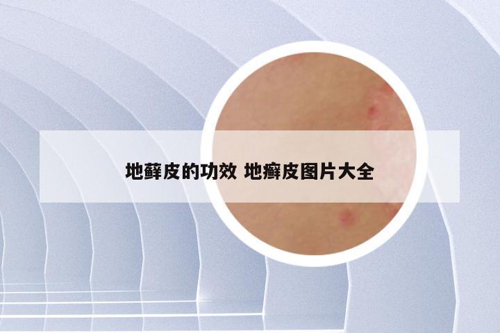 地藓皮的功效 地癣皮图片大全