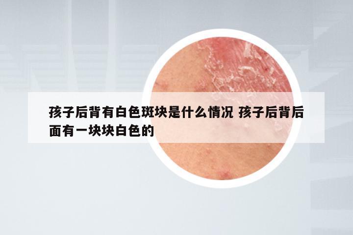 孩子后背有白色斑块是什么情况 孩子后背后面有一块块白色的
