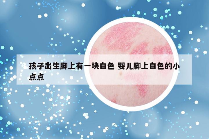 孩子出生脚上有一块白色 婴儿脚上白色的小点点