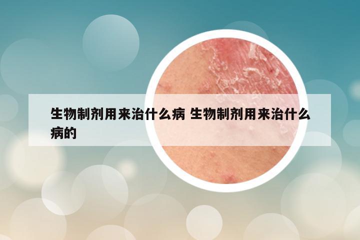 生物制剂用来治什么病 生物制剂用来治什么病的
