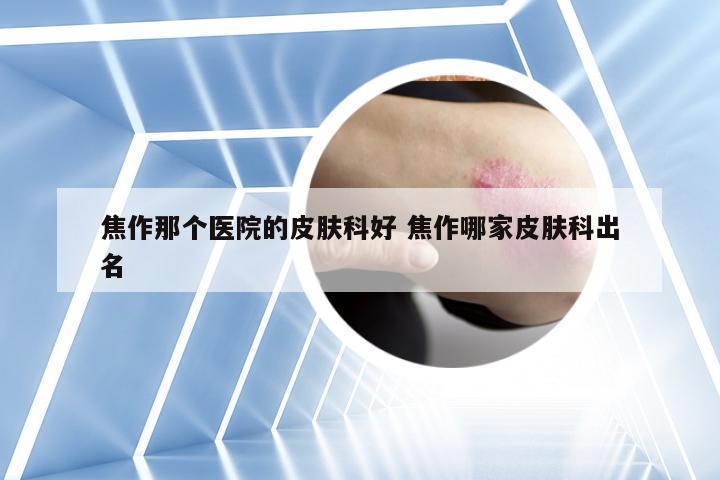 焦作那个医院的皮肤科好 焦作哪家皮肤科出名