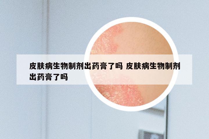 皮肤病生物制剂出药膏了吗 皮肤病生物制剂出药膏了吗