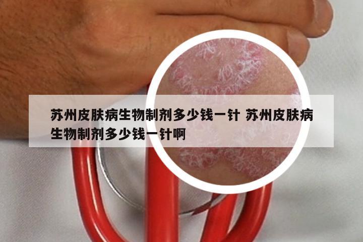 苏州皮肤病生物制剂多少钱一针 苏州皮肤病生物制剂多少钱一针啊