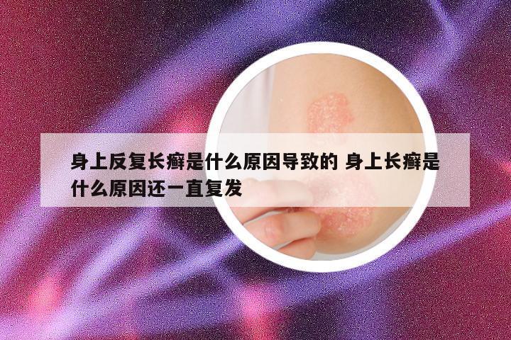 身上反复长癣是什么原因导致的 身上长癣是什么原因还一直复发