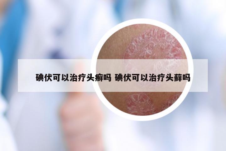碘伏可以治疗头癣吗 碘伏可以治疗头藓吗