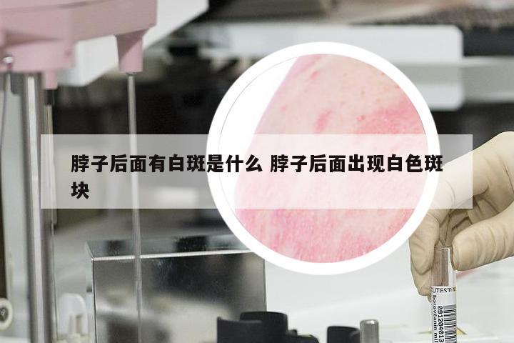 脖子后面有白斑是什么 脖子后面出现白色斑块