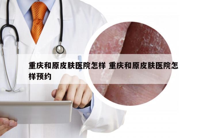重庆和原皮肤医院怎样 重庆和原皮肤医院怎样预约