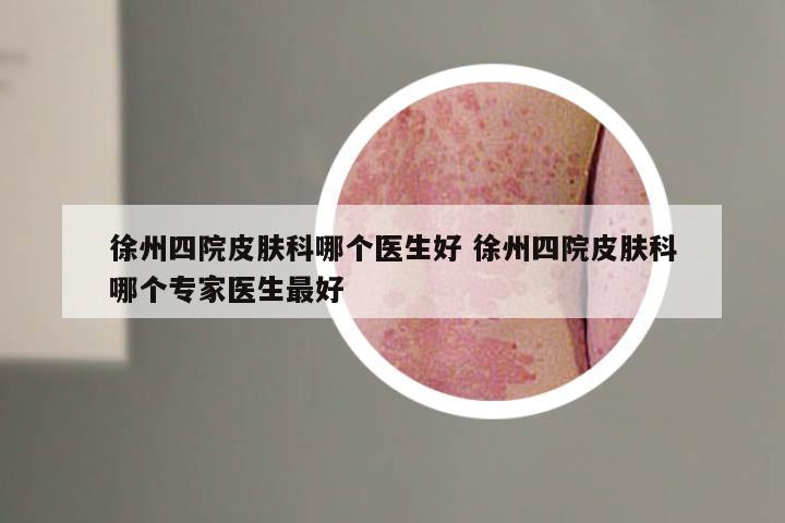 徐州四院皮肤科哪个医生好 徐州四院皮肤科哪个专家医生最好
