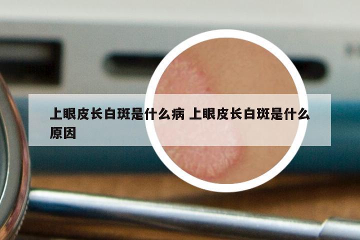 上眼皮长白斑是什么病 上眼皮长白斑是什么原因