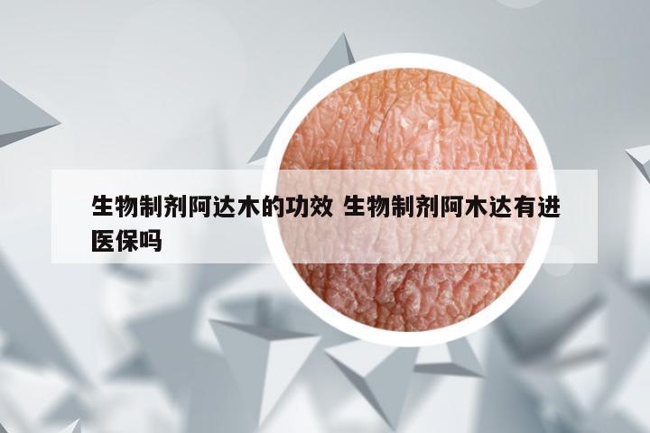 生物制剂阿达木的功效 生物制剂阿木达有进医保吗