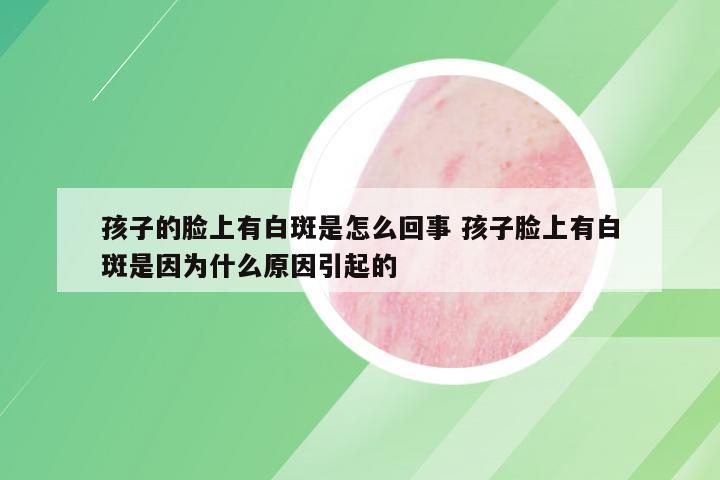 孩子的脸上有白斑是怎么回事 孩子脸上有白斑是因为什么原因引起的