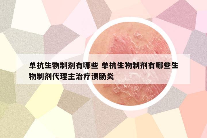 单抗生物制剂有哪些 单抗生物制剂有哪些生物制剂代理主治疗溃肠炎