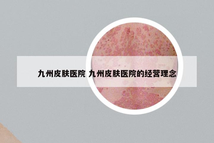 九州皮肤医院 九州皮肤医院的经营理念