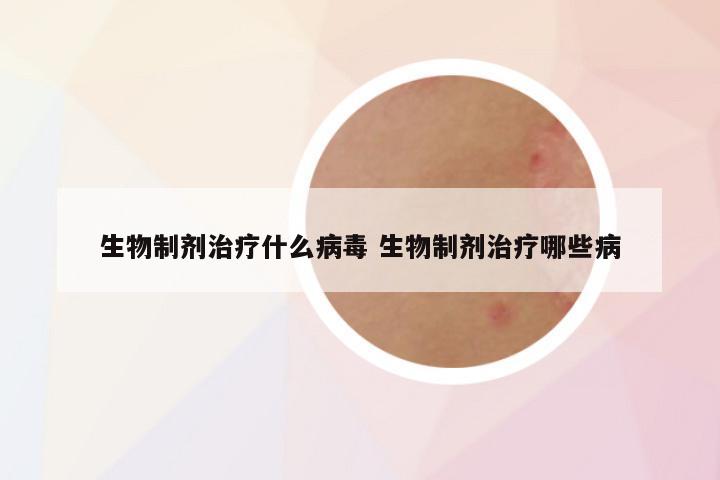 生物制剂治疗什么病毒 生物制剂治疗哪些病