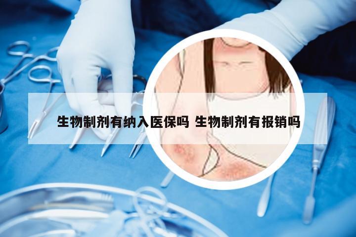 生物制剂有纳入医保吗 生物制剂有报销吗