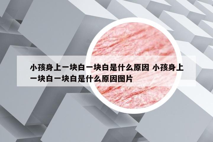 小孩身上一块白一块白是什么原因 小孩身上一块白一块白是什么原因图片