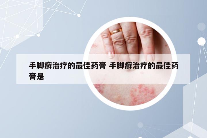 手脚癣治疗的最佳药膏 手脚癣治疗的最佳药膏是
