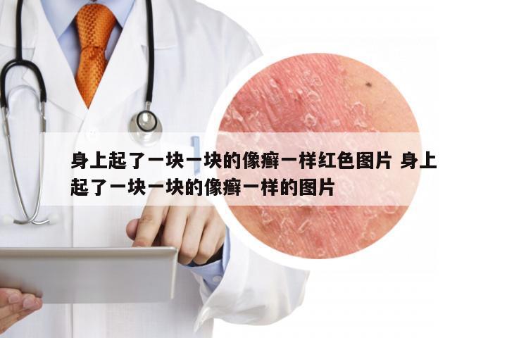 身上起了一块一块的像癣一样红色图片 身上起了一块一块的像癣一样的图片