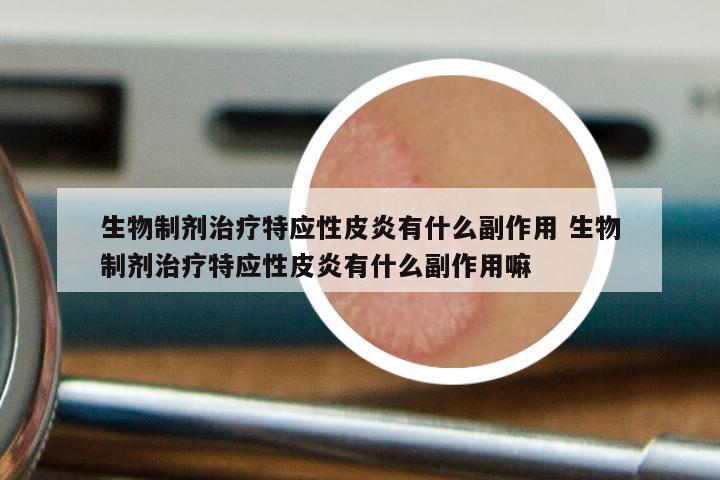 生物制剂治疗特应性皮炎有什么副作用 生物制剂治疗特应性皮炎有什么副作用嘛